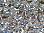 TXNDC16 Antibody in Immunohistochemistry (Paraffin) (IHC (P))