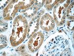 TXNDC16 Antibody in Immunohistochemistry (Paraffin) (IHC (P))