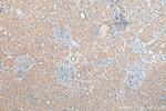 TXNDC16 Antibody in Immunohistochemistry (Paraffin) (IHC (P))