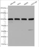 TXNDC16 Antibody in Western Blot (WB)