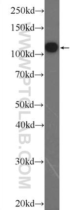 TXNDC16 Antibody in Western Blot (WB)