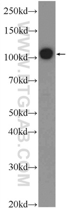 TXNDC16 Antibody in Western Blot (WB)