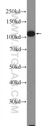 TXNDC16 Antibody in Western Blot (WB)