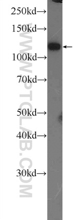 TXNDC16 Antibody in Western Blot (WB)