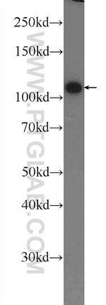 TXNDC16 Antibody in Western Blot (WB)