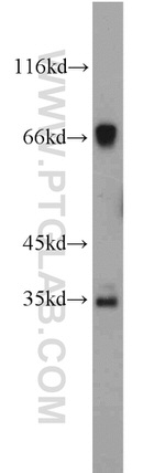 C19orf44 Antibody in Western Blot (WB)