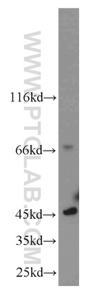 C19orf44 Antibody in Western Blot (WB)