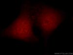 Arp5/ACTR5 Antibody in Immunocytochemistry (ICC/IF)