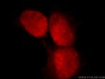 C1orf106 Antibody in Immunocytochemistry (ICC/IF)