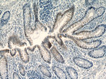 C1orf106 Antibody in Immunohistochemistry (Paraffin) (IHC (P))