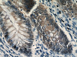 C1orf106 Antibody in Immunohistochemistry (Paraffin) (IHC (P))