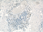 C1orf106 Antibody in Immunohistochemistry (Paraffin) (IHC (P))