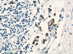 C1orf106 Antibody in Immunohistochemistry (Paraffin) (IHC (P))