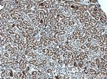 C1orf106 Antibody in Immunohistochemistry (Paraffin) (IHC (P))