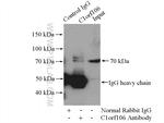 C1orf106 Antibody in Immunoprecipitation (IP)