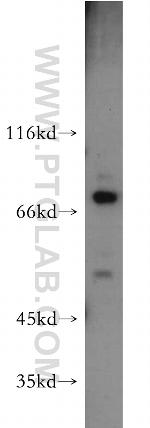 C1orf106 Antibody in Western Blot (WB)