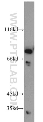 C1orf106 Antibody in Western Blot (WB)