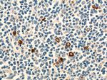 KLRF1 Antibody in Immunohistochemistry (Paraffin) (IHC (P))