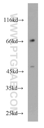 KLRF1 Antibody in Western Blot (WB)