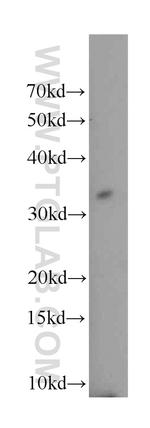 TNFRSF13B Antibody in Western Blot (WB)