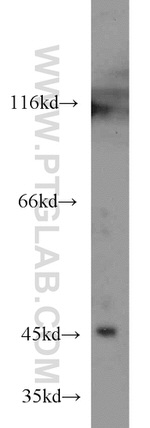 EXOG Antibody in Western Blot (WB)