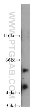 CCT4 Antibody in Western Blot (WB)