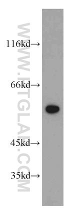 CCT4 Antibody in Western Blot (WB)