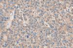 CCT4 Antibody in Immunohistochemistry (Paraffin) (IHC (P))