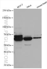 CCT4 Antibody in Western Blot (WB)