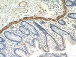 MYLK3 Antibody in Immunohistochemistry (Paraffin) (IHC (P))