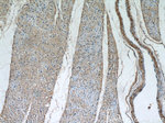 MYLK3 Antibody in Immunohistochemistry (Paraffin) (IHC (P))