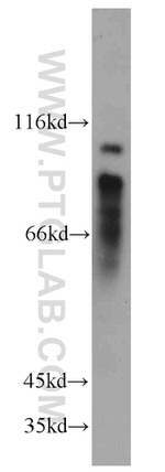 MYLK3 Antibody in Western Blot (WB)