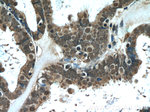 L1TD1 Antibody in Immunohistochemistry (Paraffin) (IHC (P))