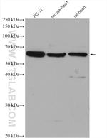 FOXO4 Antibody in Western Blot (WB)