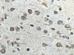 FAM134B Antibody in Immunohistochemistry (Paraffin) (IHC (P))