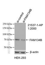 FAM134B Antibody in Western Blot (WB)