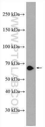 FAM134B Antibody in Western Blot (WB)