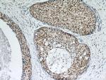 GABPA Antibody in Immunohistochemistry (Paraffin) (IHC (P))