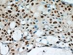 GABPA Antibody in Immunohistochemistry (Paraffin) (IHC (P))