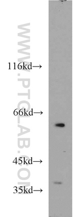 GABPA Antibody in Western Blot (WB)