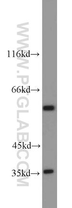 GABPA Antibody in Western Blot (WB)