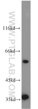 GABPA Antibody in Western Blot (WB)