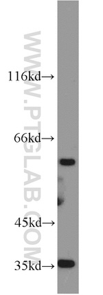 GABPA Antibody in Western Blot (WB)