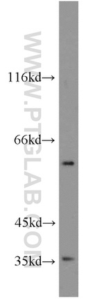 GABPA Antibody in Western Blot (WB)