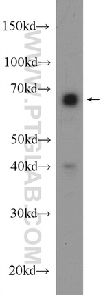 GABPA Antibody in Western Blot (WB)