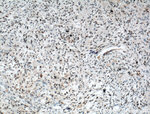 ZEB1 Antibody in Immunohistochemistry (Paraffin) (IHC (P))