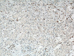 ZEB1 Antibody in Immunohistochemistry (Paraffin) (IHC (P))