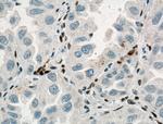 ZEB1 Antibody in Immunohistochemistry (Paraffin) (IHC (P))