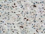 ZEB1 Antibody in Immunohistochemistry (Paraffin) (IHC (P))