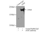 ZEB1 Antibody in Immunoprecipitation (IP)